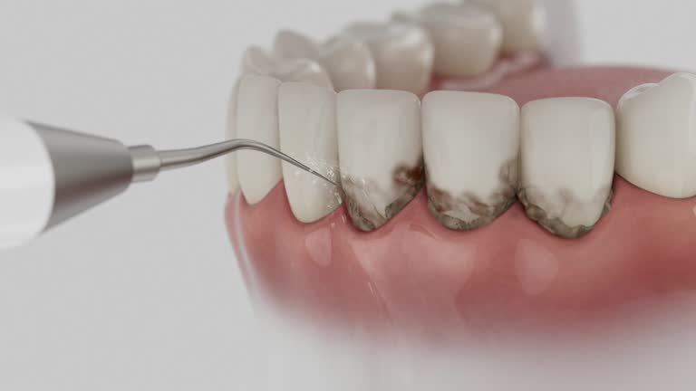 Reliable Emergency Dentist contractor in Ladera, CA by Smile Center Dentistry